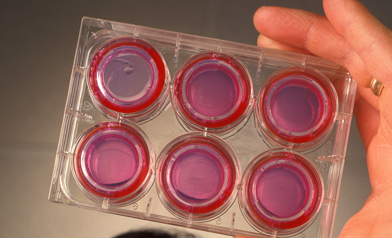 Scientist holding an in-vitro artificial gut consisting of half-dollar-sized culture wells with a dialysis membrane attached to a plastic insert. 