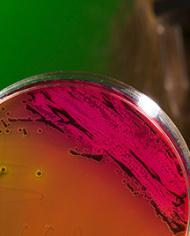 An agar plate with a well-isolated Salmonella colony 