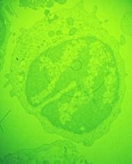 Macrophage cell in early stages of infection with African swine fever virus, magnified about 1,000x. 