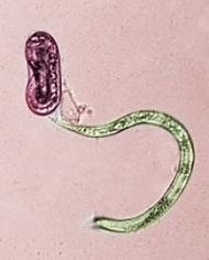 Colorized microscopic image of two juvenile guava root-knot nematodes, one newly hatched and one still unhatched within its ovoid egg. 