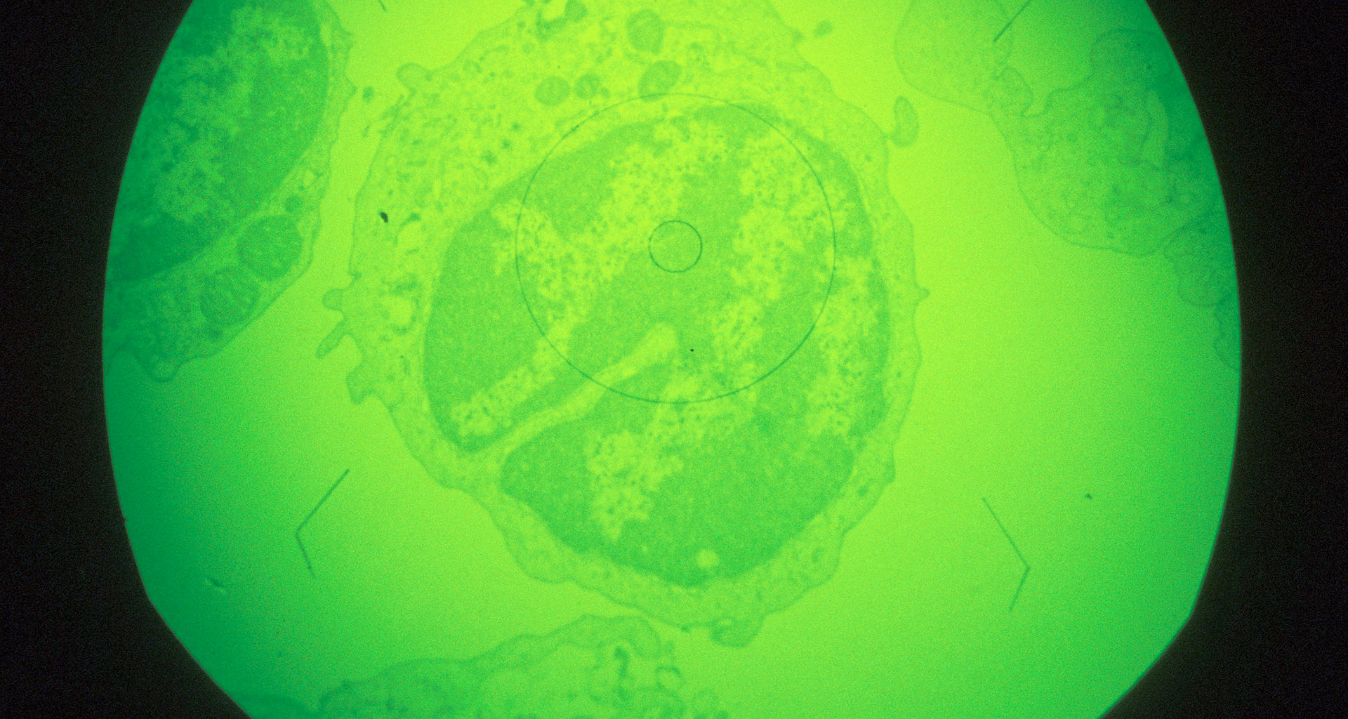 Macrophage cell in early stages of infection with African swine fever virus, magnified about 1,000x. 