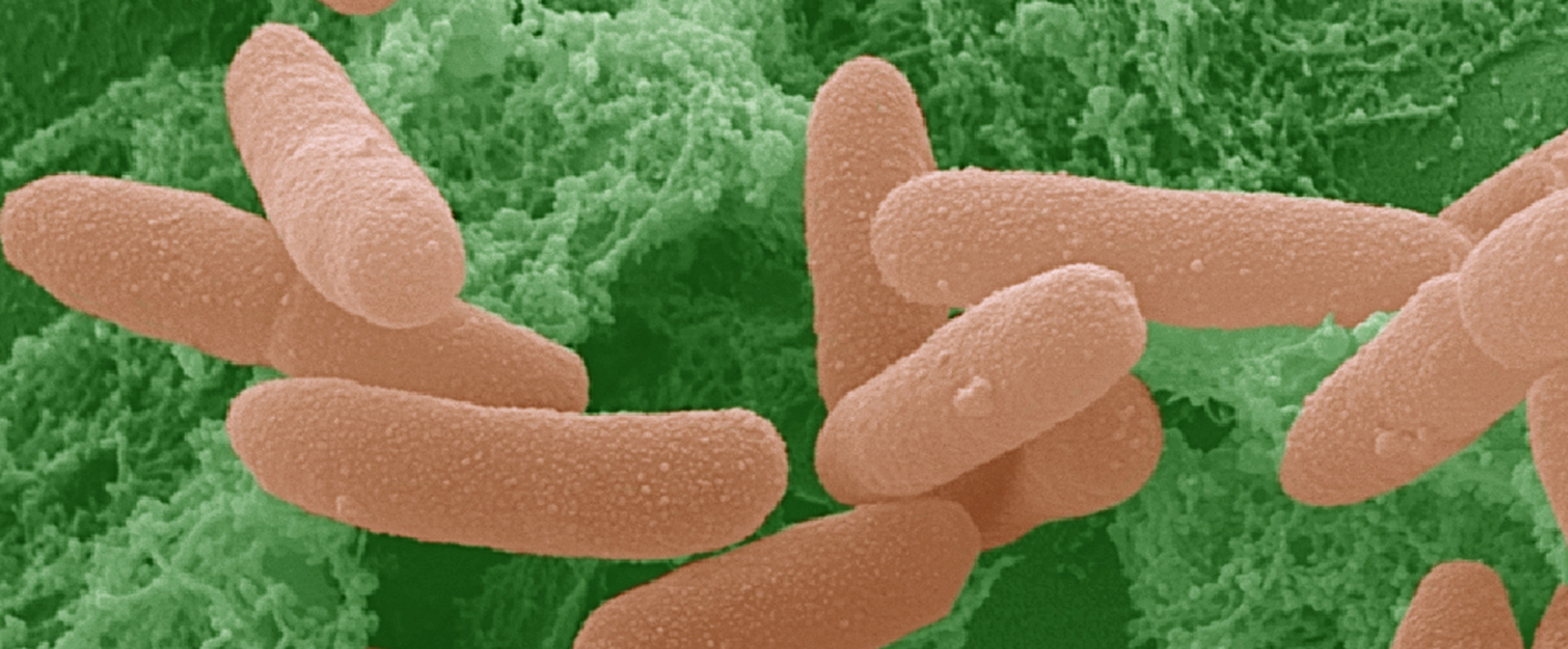 Scanning electron micrograph of E. coli on a lettuce leaf