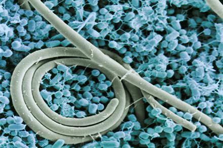 Scanning electron micrograph shows cells of Salmonella enteritidis 