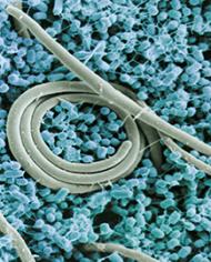 This scanning electron micrograph shows Salmonella enteritidis cells 